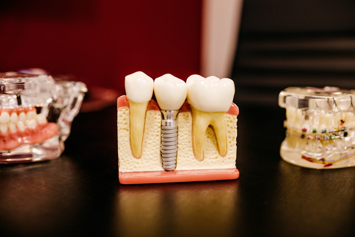 A dental implant model showing teeth
